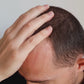 Hairs n You MIRAGE Excellence | Premium Hair Patch for Men